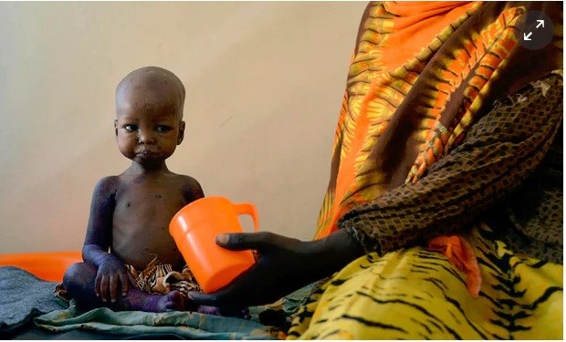 A malnourished child is fed a special formula by her mother at a regional hospital in Baidoa. Photograph: Tony Karumba/AFP/Getty Images